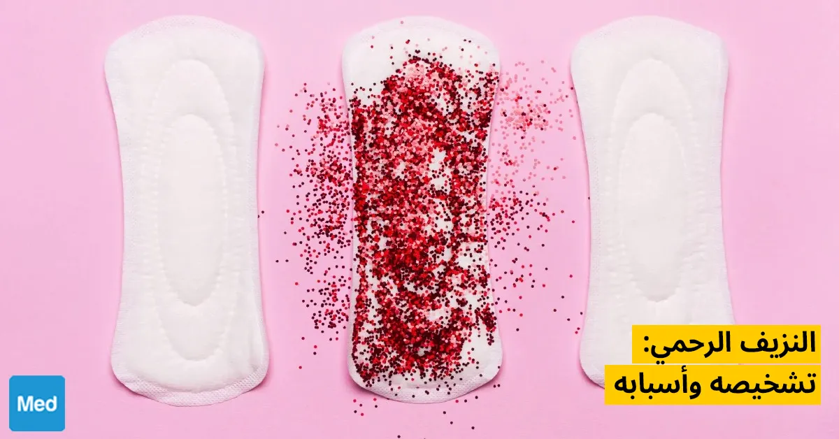 النزيف الرحمي: تشخيصه وأسبابه